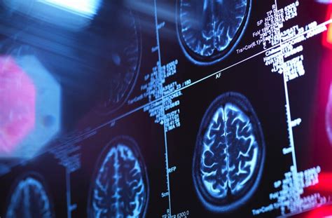 From Brain to Practice: Neuroscience Programs in Top US Universities